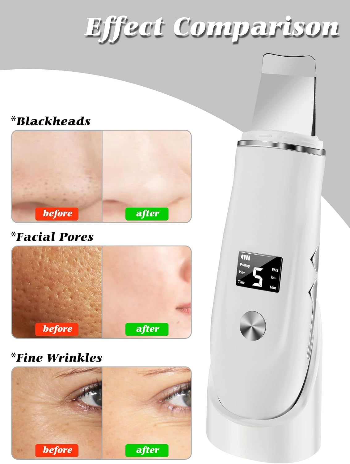 4-in-1 Ultrasonic Facial Skin Scrubber and Blackhead Remover