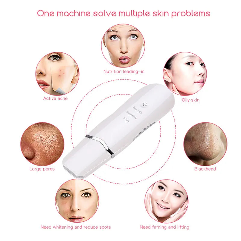 3-in-1 Ultrasonic Facial Skin Scrubber and Pore Cleaner