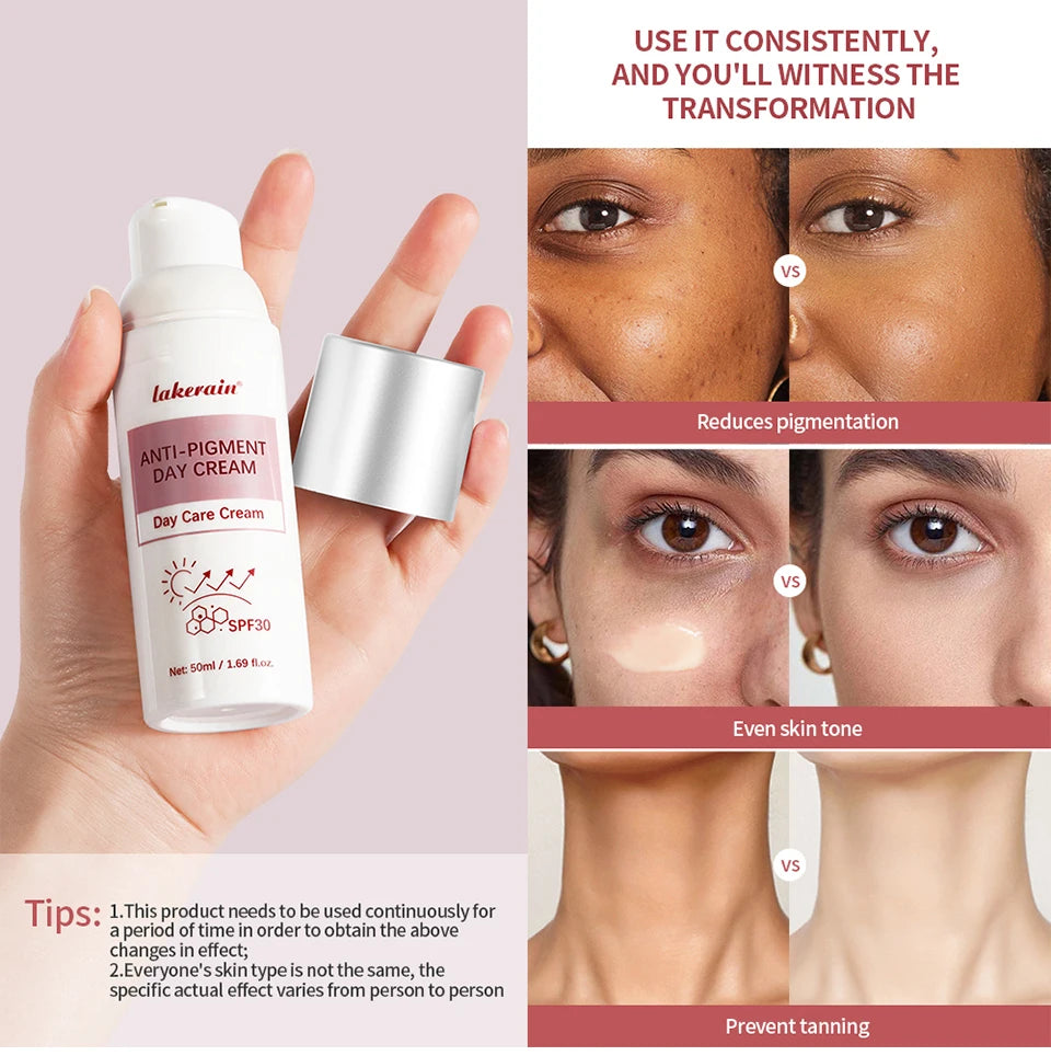 Anti-Pigment SPF 30 Moisturizing Day Cream for Face