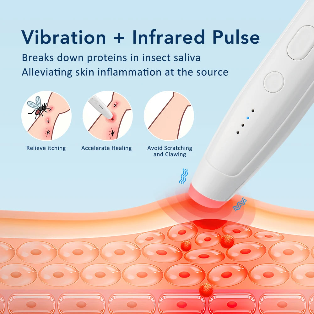 Electronic Itch Relief Pen for Insect Bites and Stings