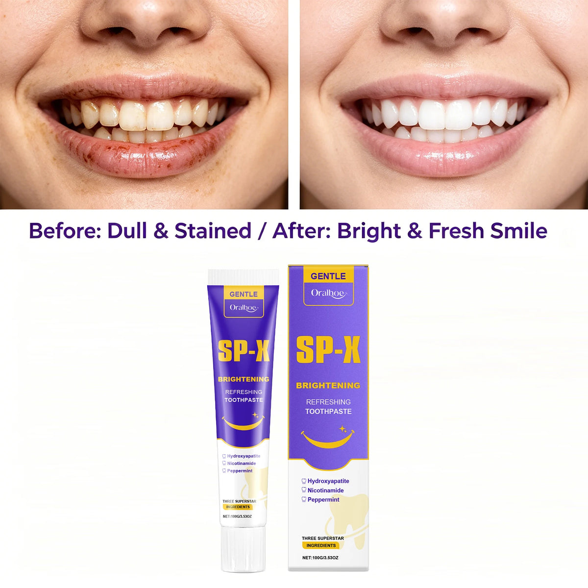 Brightening Toothpaste for Teeth Whitening and Stain Removal