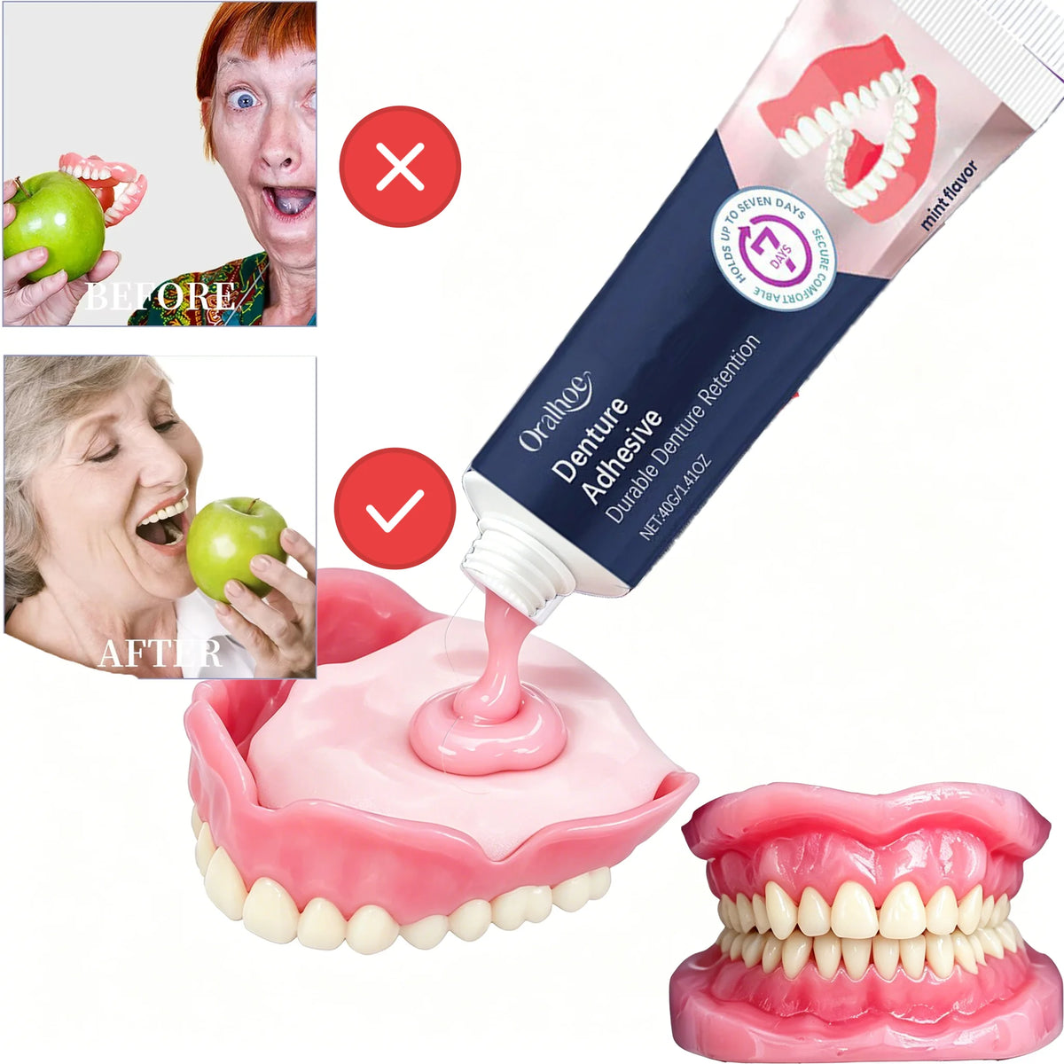 Thermoplastic Denture Adhesive for Secure and Comfortable Fit