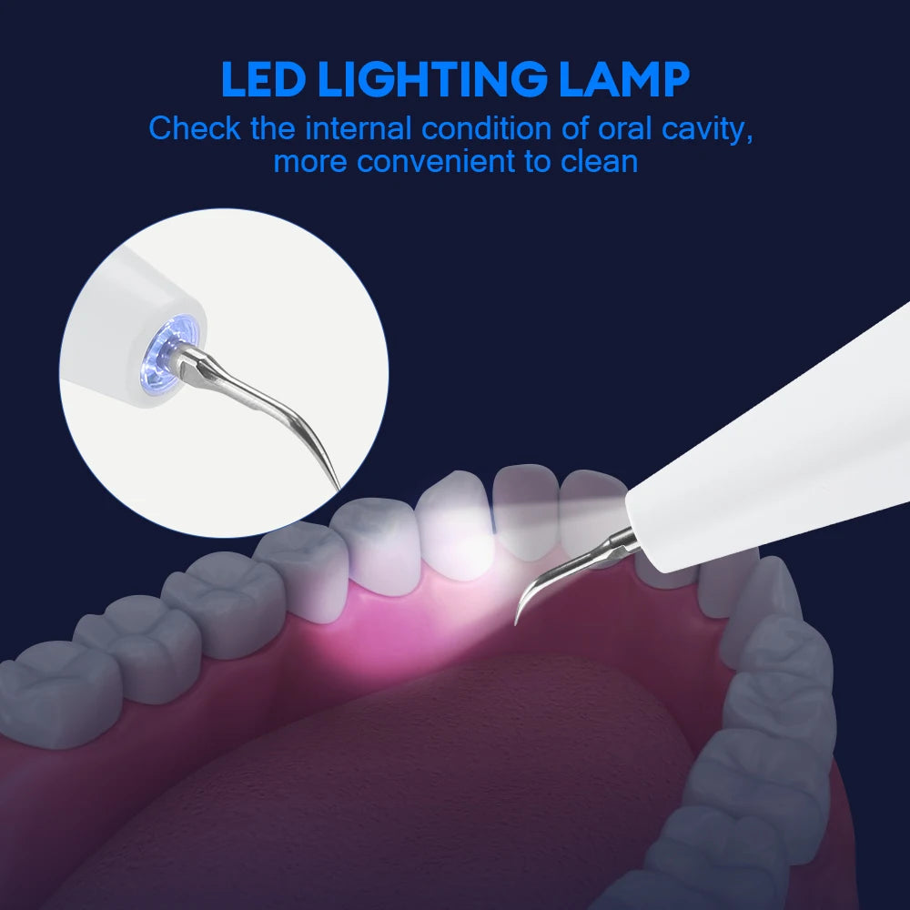 Ultrasonic Electric Teeth Cleaner and Tartar Remover