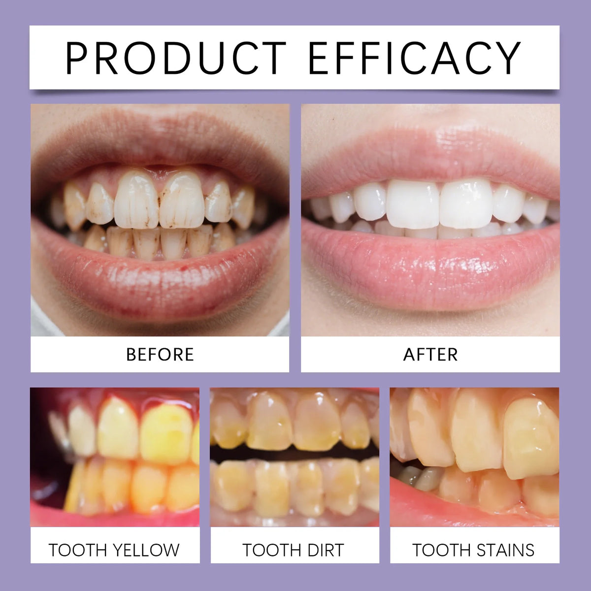 Bee Venom Gum Repair and Teeth Whitening Toothpaste