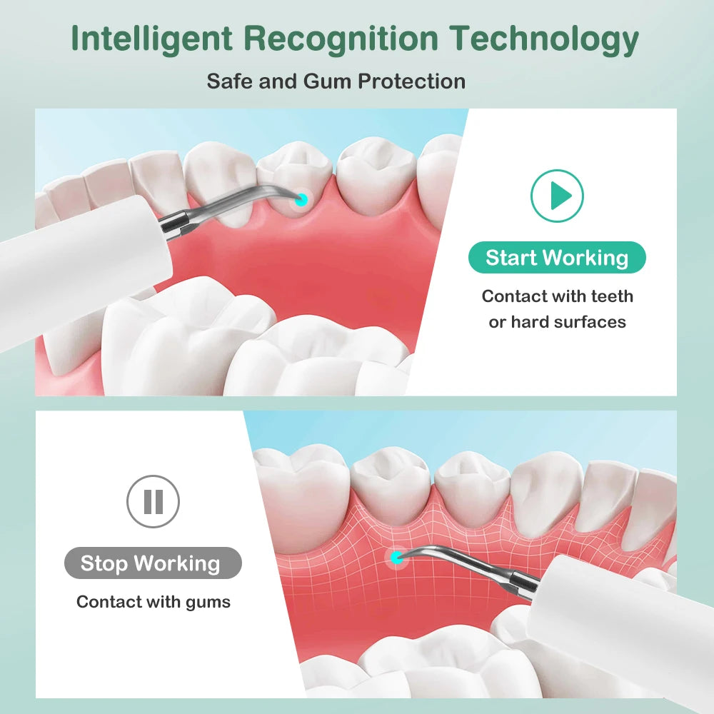 Ultrasonic Electric Teeth Tartar and Plaque Remover