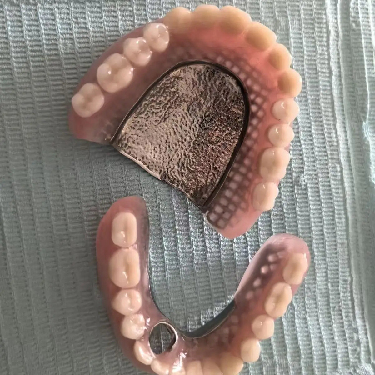Suction-Retained Full Mouth Dentures for Seniors