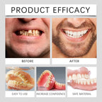 Temporary Denture Fitting and Dental Retouching Kit