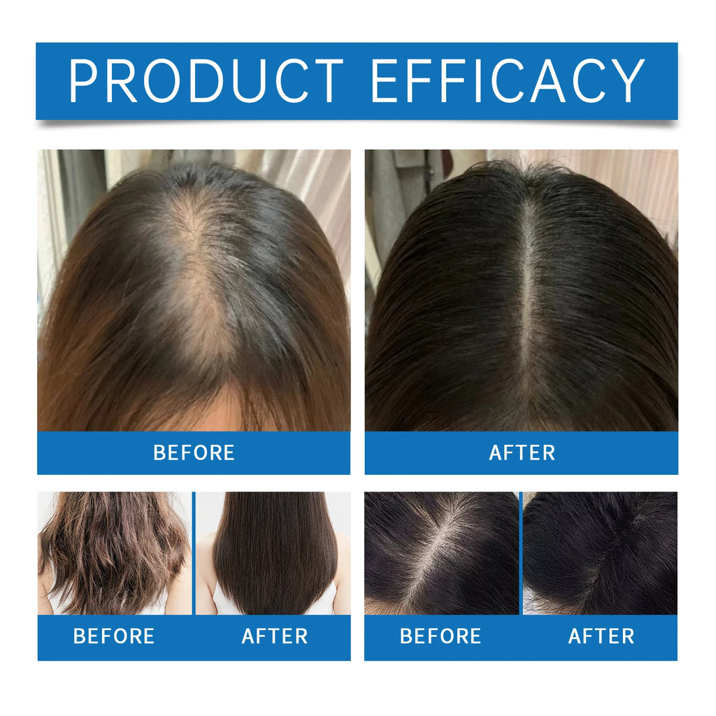 Rosemary Hair Growth Scalp Serum Roller