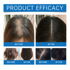 Rosemary Hair Growth Scalp Serum Roller