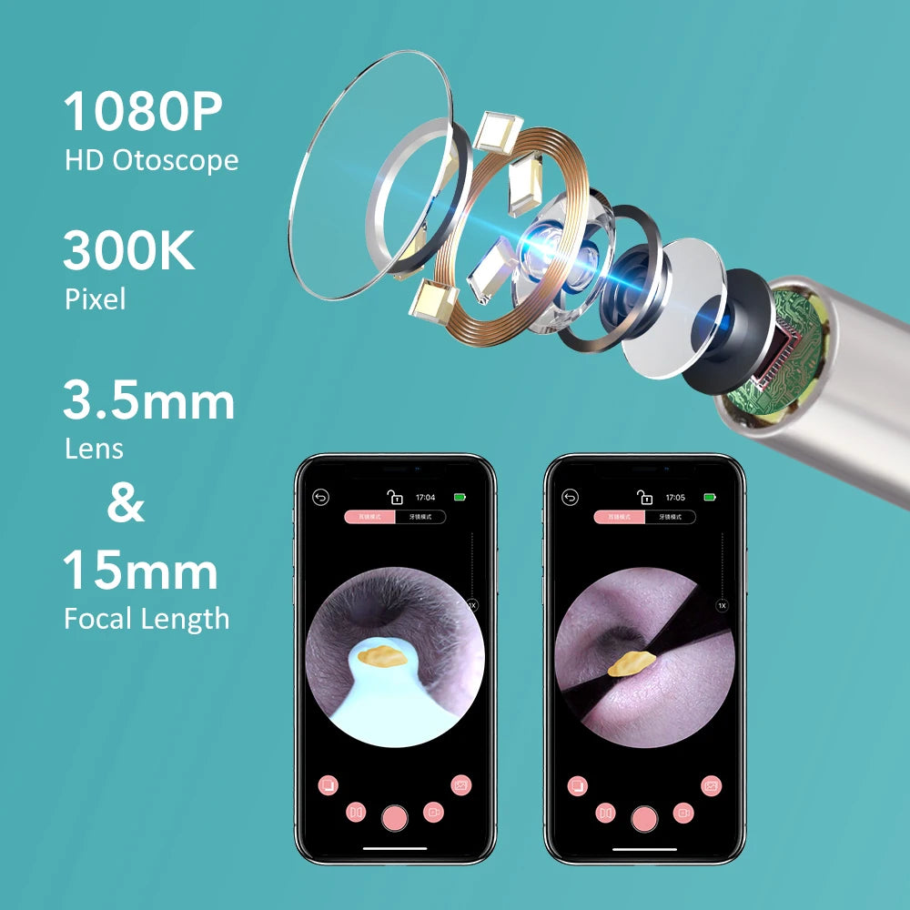 Visual Ear Wax Cleaner with HD Camera and Tweezers