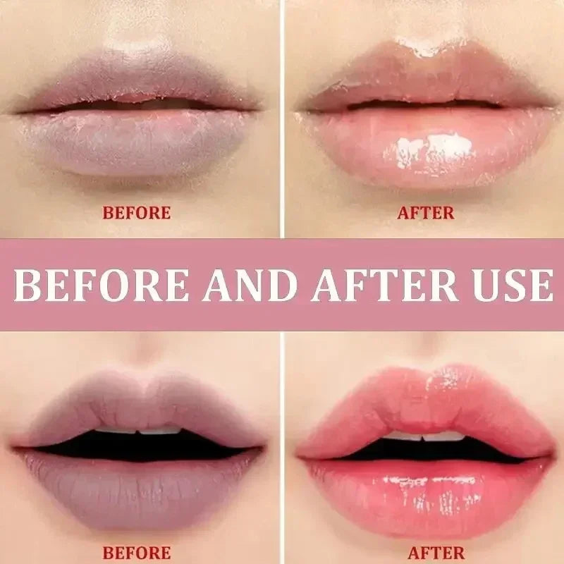 Exfoliating Lip Balm for Dark Spot Correction and Moisture Repair - 5