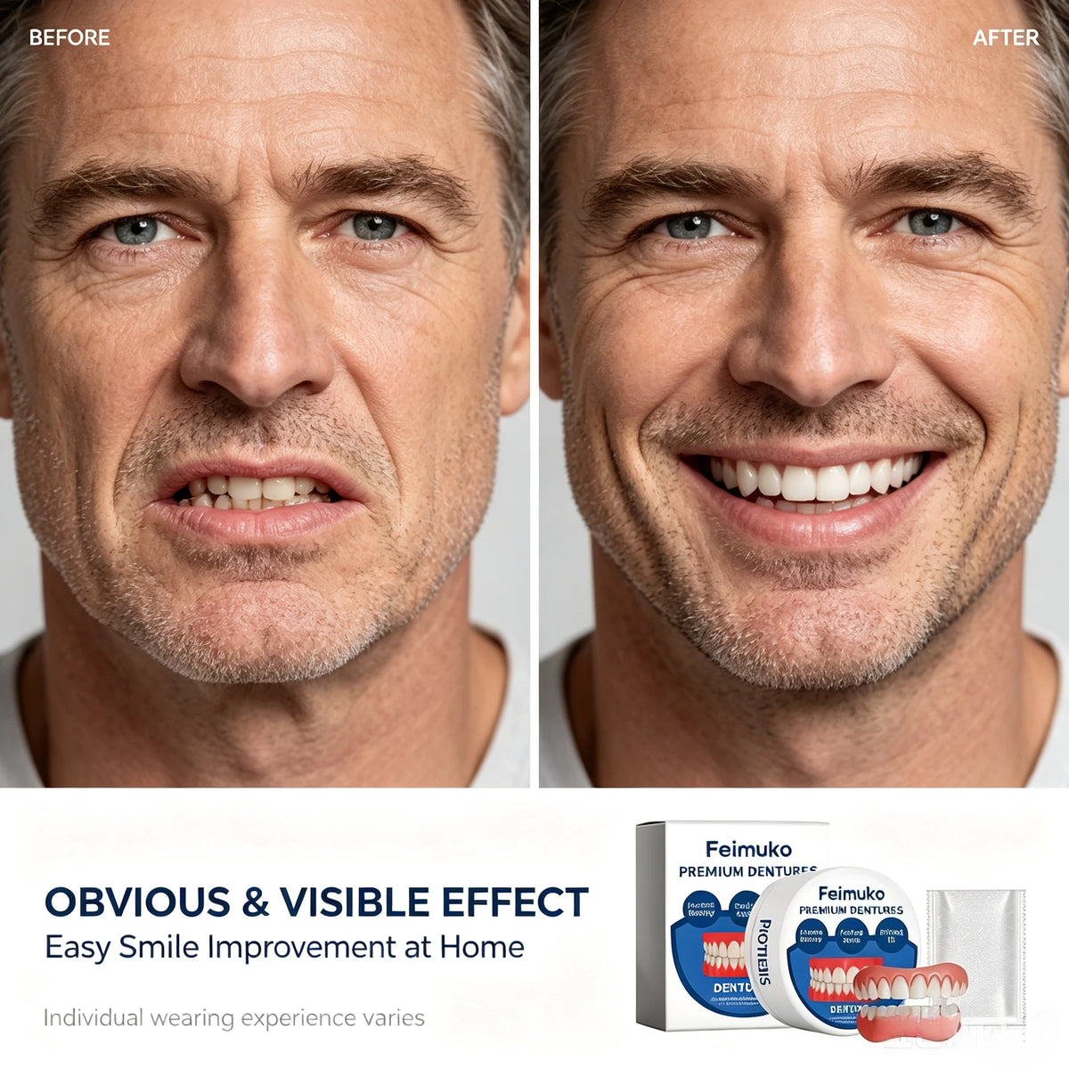 Instant Comfort Silicone Snap-On Dentures for Natural Smile