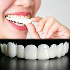 Instant Snap-On Temporary Dentures for Smile Correction