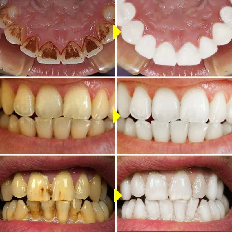 Probiotic Teeth Whitening Toothpaste for Stain Removal and Fresh Breath - 2