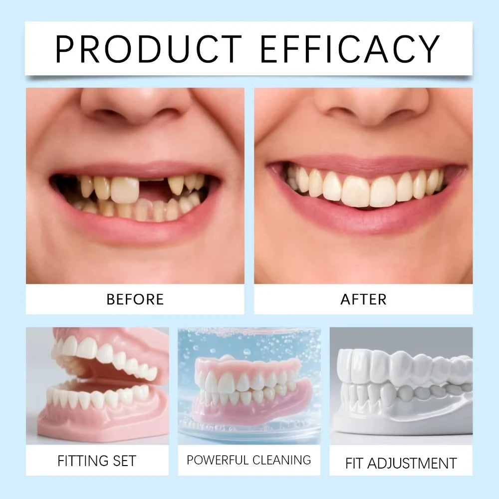 Temporary Silicone Smile Veneers for Upper and Lower Teeth