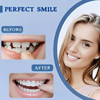 Instant Snap-On Temporary Dentures for Smile Correction