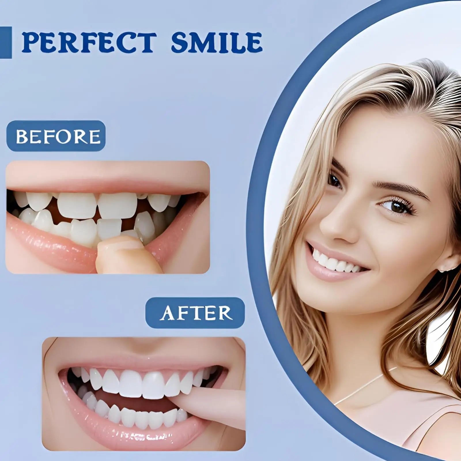 Instant Snap-On Temporary Dentures for Smile Correction