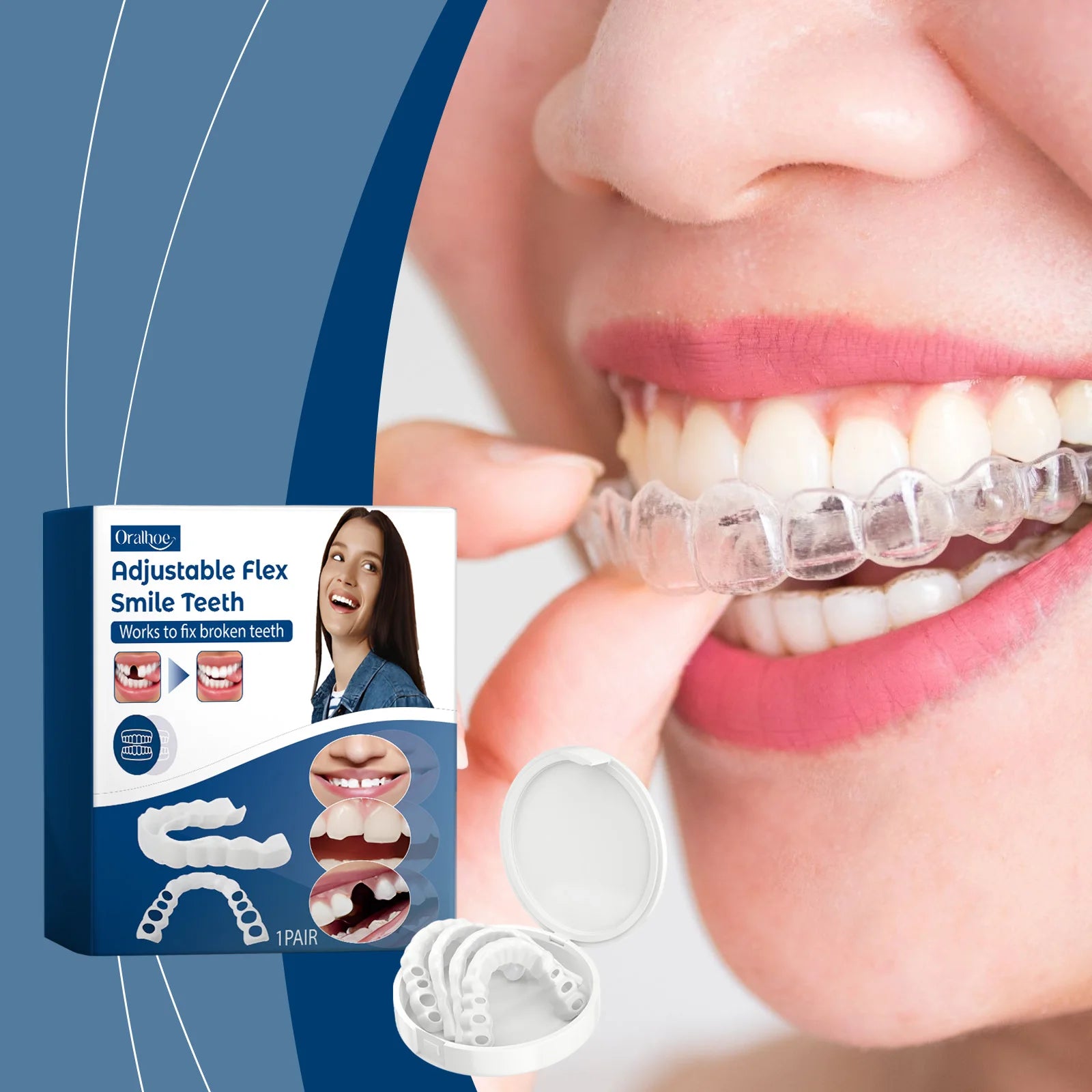 Adjustable Snap-On Dentures for Instant Smile Repair - 2