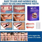 Instant Smile Cosmetic Dental Correction Plates