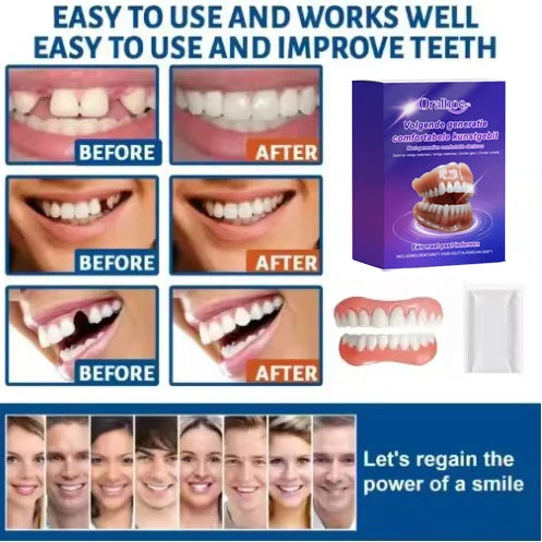 Instant Smile Cosmetic Dental Correction Plates