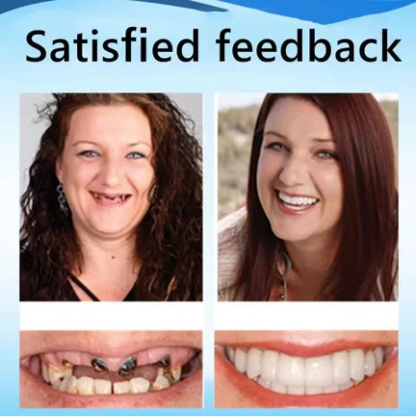 Custom Fit Silicone Dentures for Comfortable Daily Wear