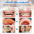 Ultrasonic Electric Teeth Cleaner and Tartar Remover