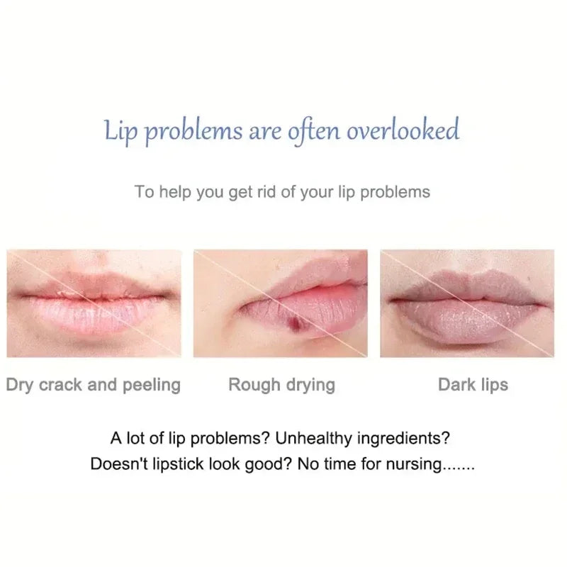 Moisturizing Lip Lightening Balm for Dark Lips and Exfoliating Repair - 7