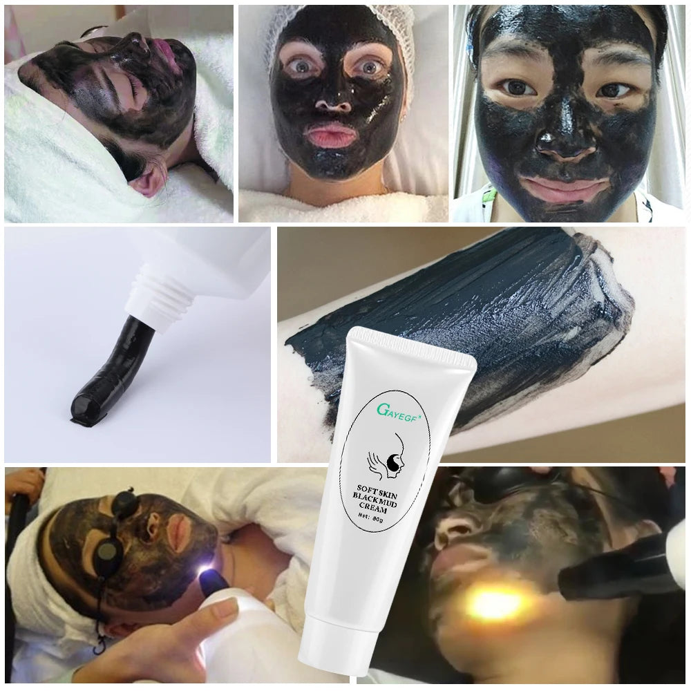 Carbon Laser Gel for Facial Deep Pore Cleansing and Skin Rejuvenation