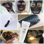 Carbon Laser Gel for Facial Deep Pore Cleansing and Skin Rejuvenation
