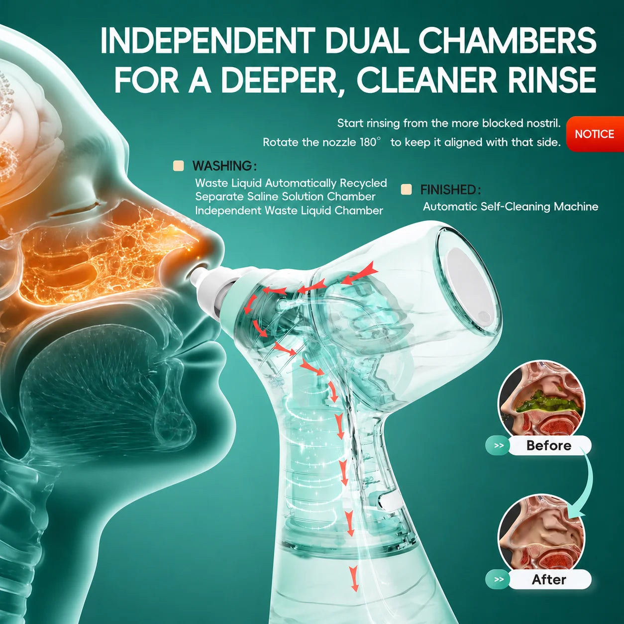 Electric Nasal Irrigator for Sinus Congestion Relief - 4