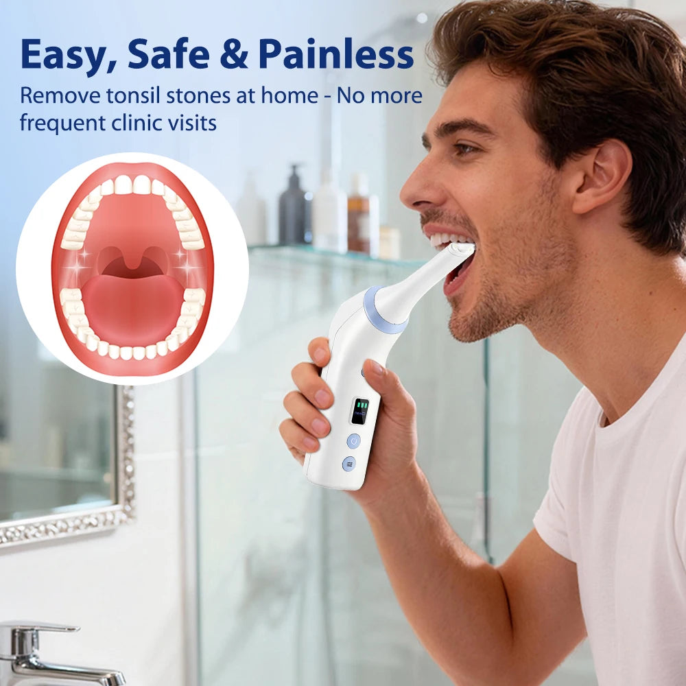 Electric Tonsil Stone Remover with LED Light