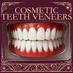 Instant Cosmetic Smile Veneers for Upper and Lower Teeth