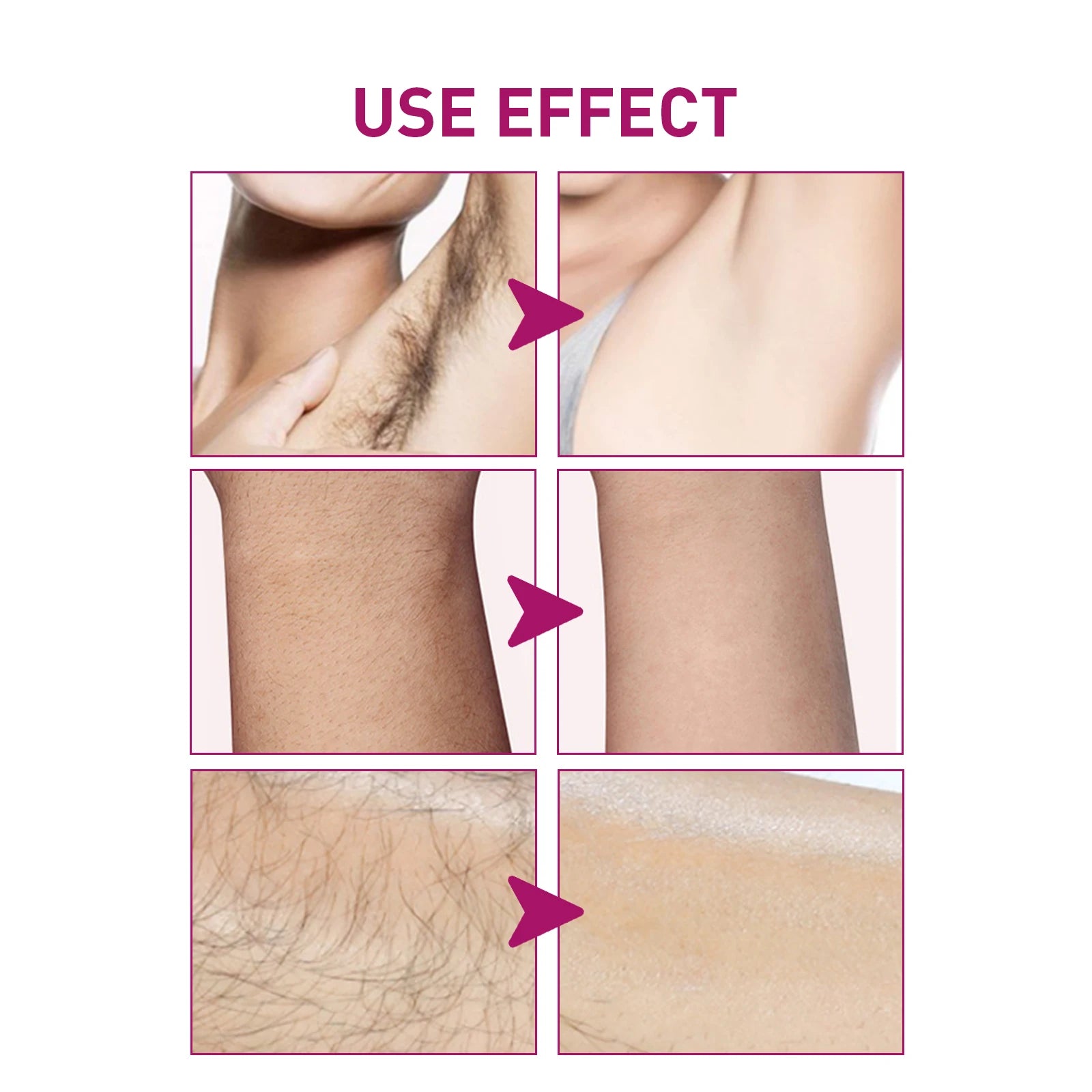 Painless Gentle Hair Removal Cream for Men and Women - 4