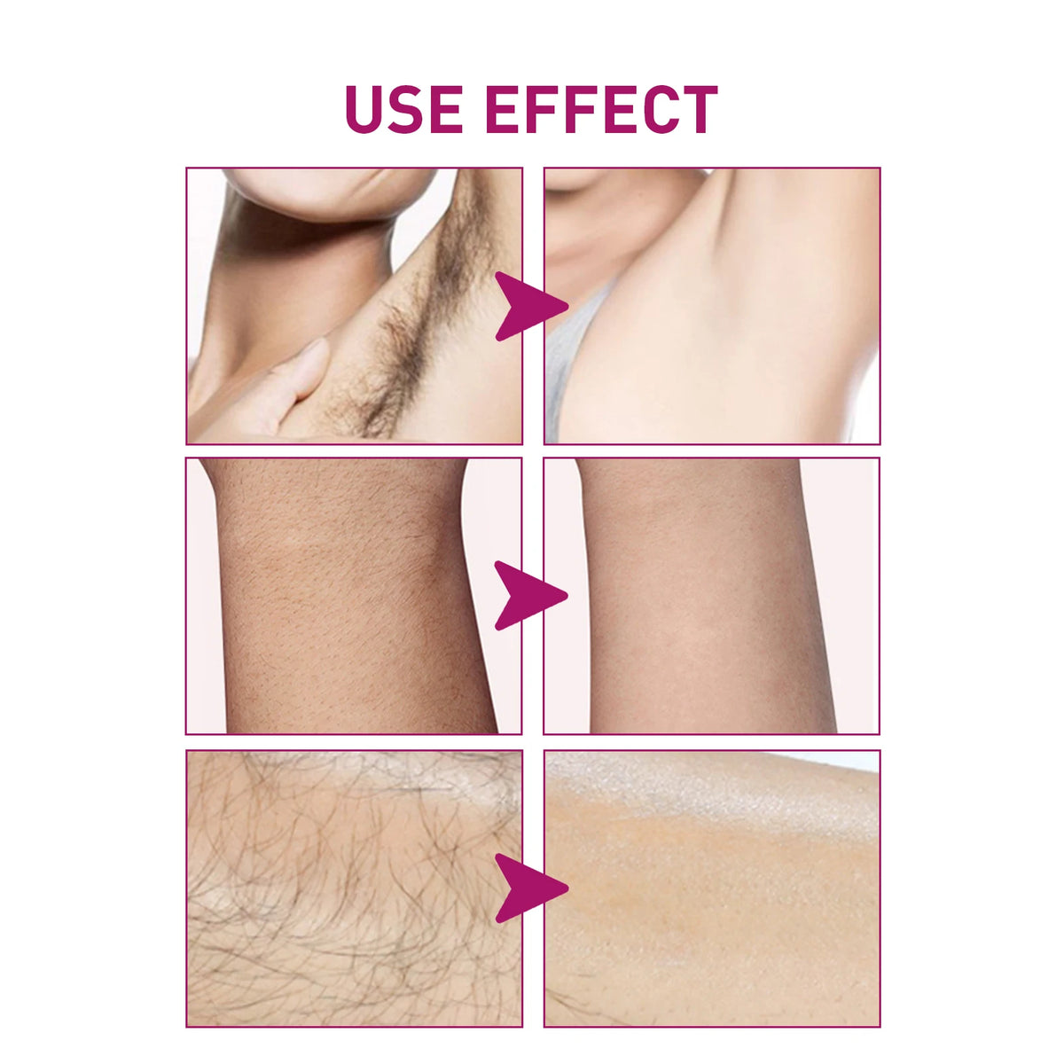 Painless Gentle Hair Removal Cream for Men and Women