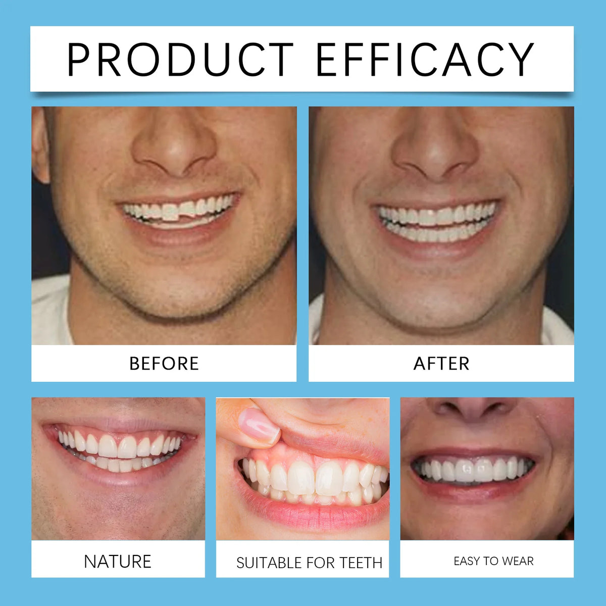 Temporary Silicone Snap-On Veneer Dentures Set