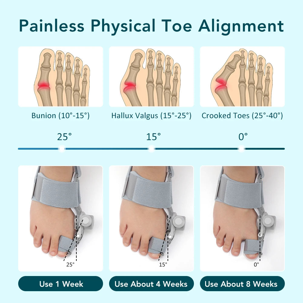 Adjustable Bunion Corrector and Toe Straightener for Foot Alignment