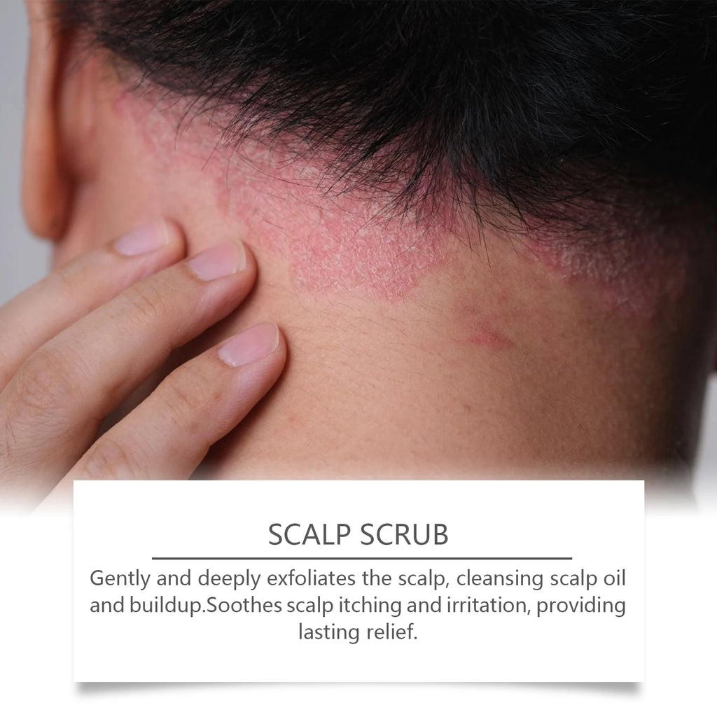 Deep Cleansing Scalp Exfoliating Scrub for Dandruff and Oil Control