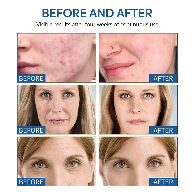 Anti-Wrinkle Lifting and Firming Face Cream