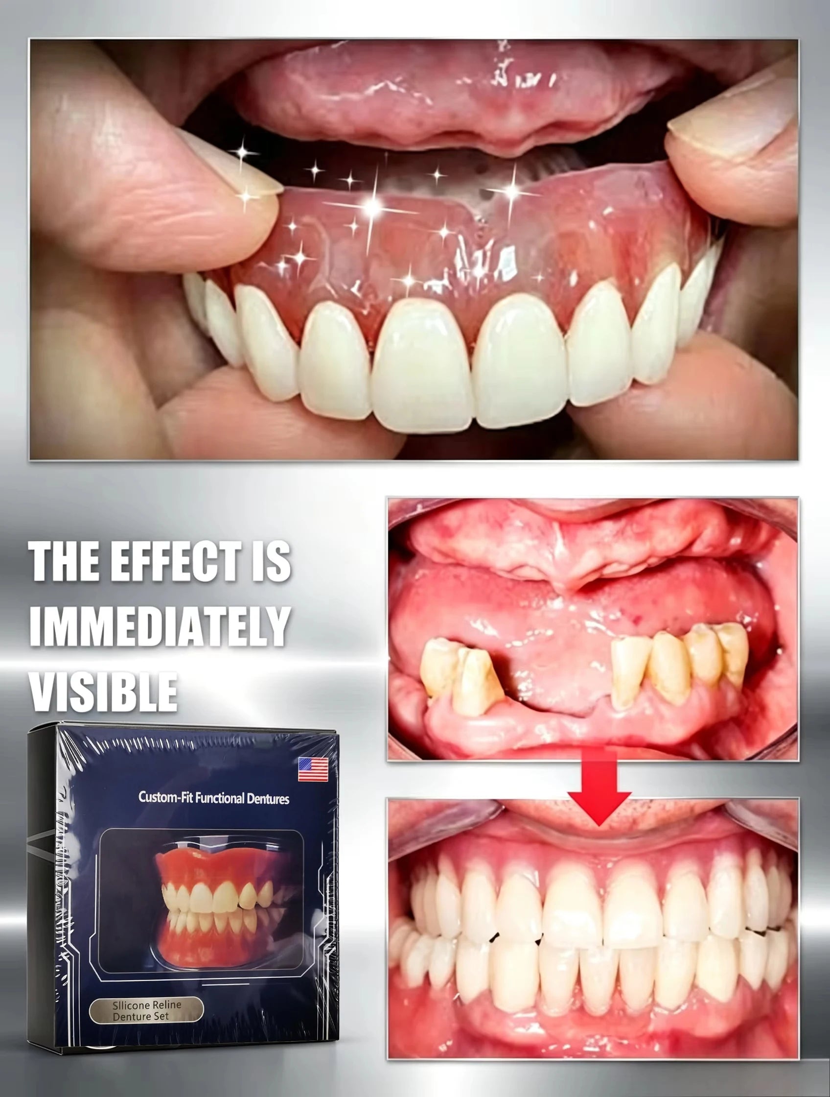 Suction-Retained Full Mouth Dentures for Seniors - 3