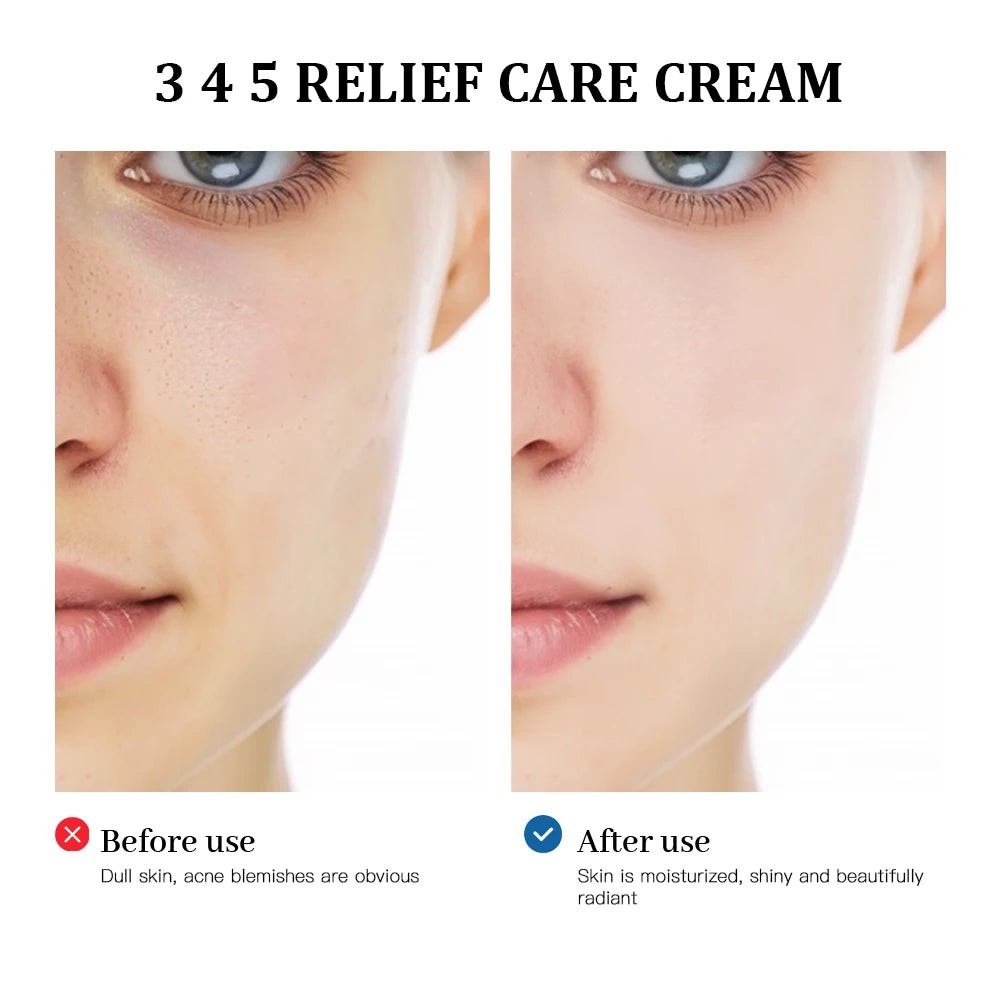 345 Relief Barrier Cream for Acne-Prone and Sensitive Skin