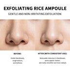 Rice Exfoliating Peeling Essence for Deep Pore Cleansing