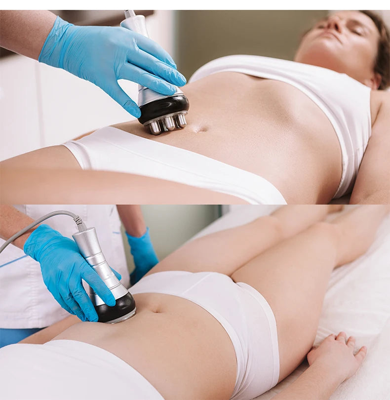 40K Ultrasonic Cavitation and RF Body Slimming Massager