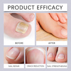 Nail Repair and Nourishing Cuticle Oil Pen