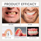 Instant Smile Cosmetic Dentures with Comfortable Silicone Gum Base