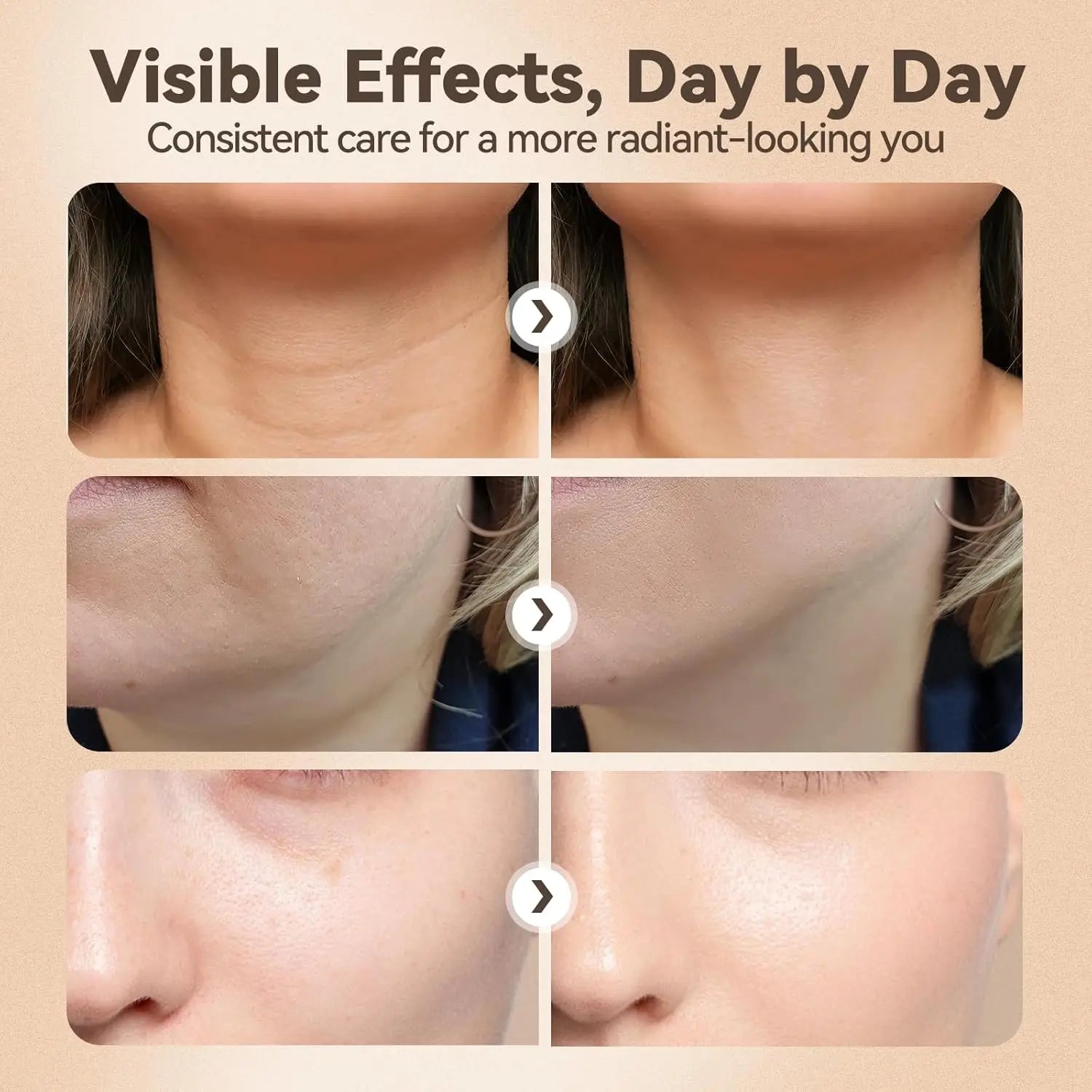 3-in-1 LED Facial Massager for Skin Tightening and Sculpting - 4