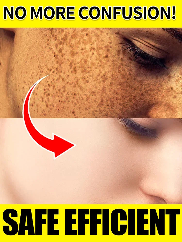 Dark Spot Correcting Facial Serum for Radiant Skin - 1