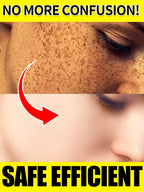 Dark Spot Correcting Facial Serum for Radiant Skin
