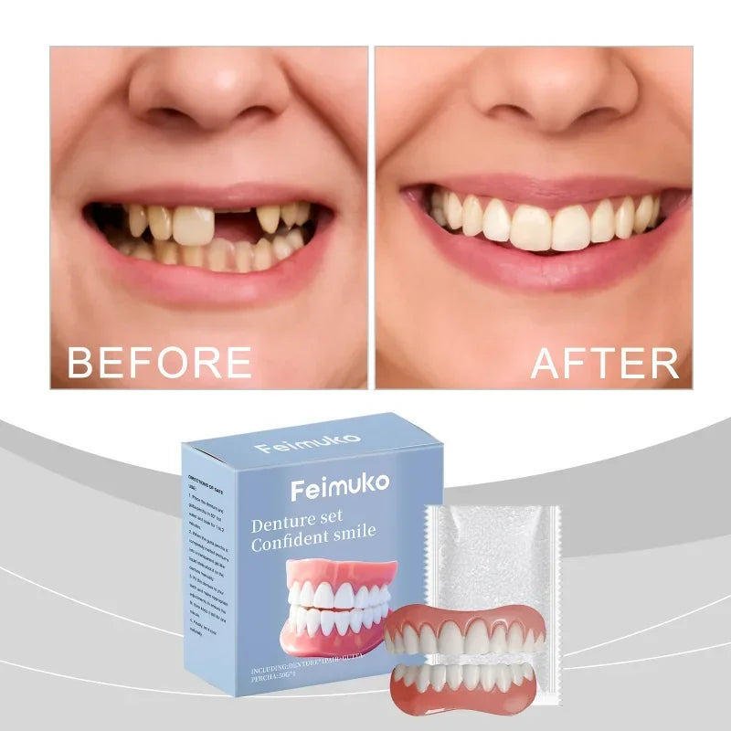 Temporary Cosmetic Denture Set for Instant Smile Restoration
