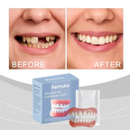 Temporary Cosmetic Denture Set for Instant Smile Restoration