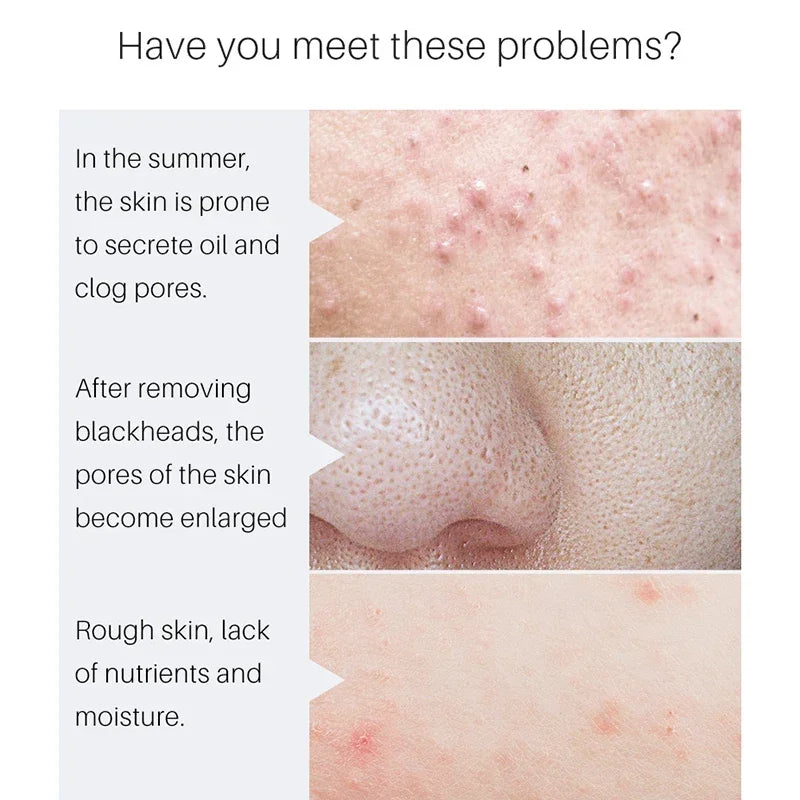 Pore Minimizing Facial Tightening Serum